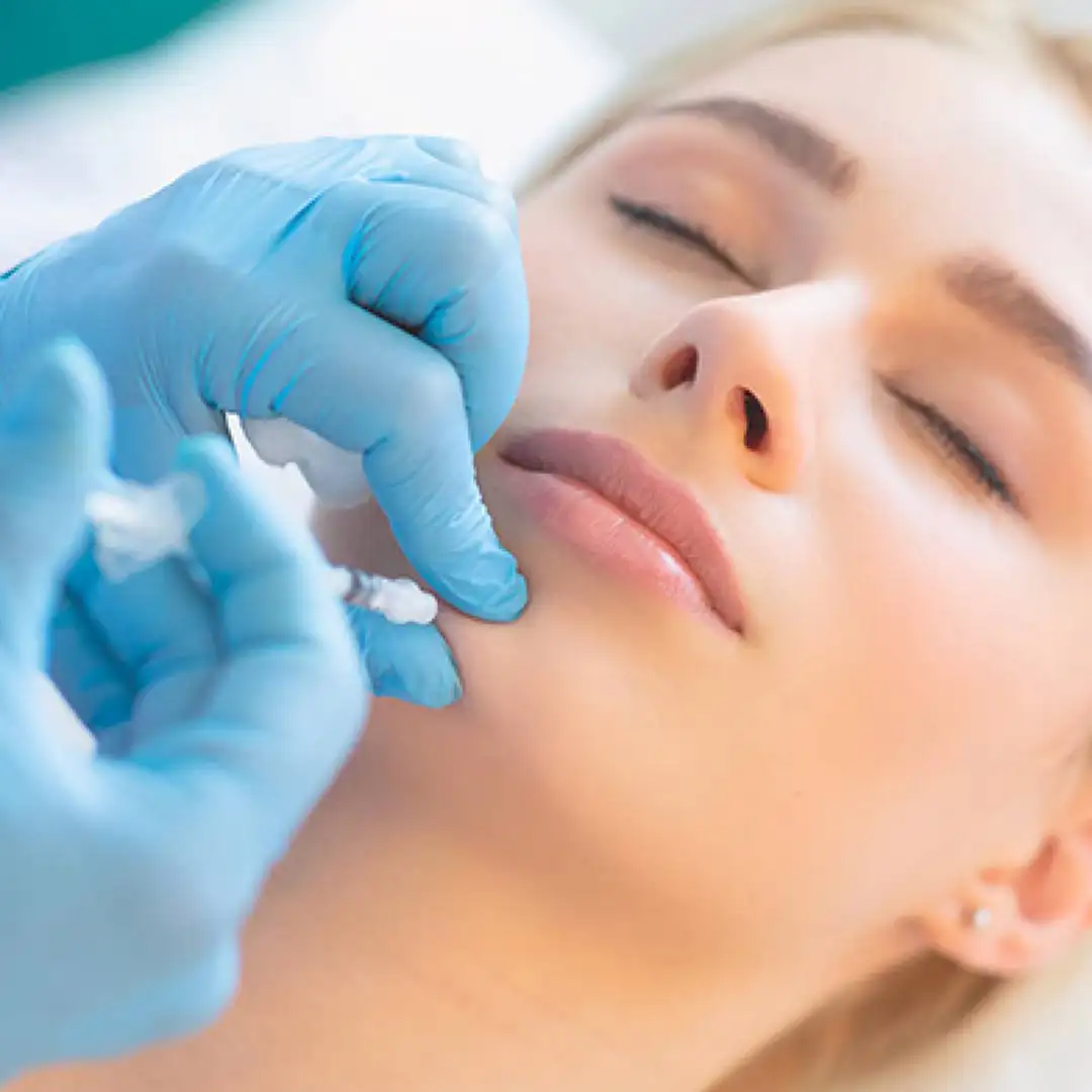 Chin Augmentation Filler 
