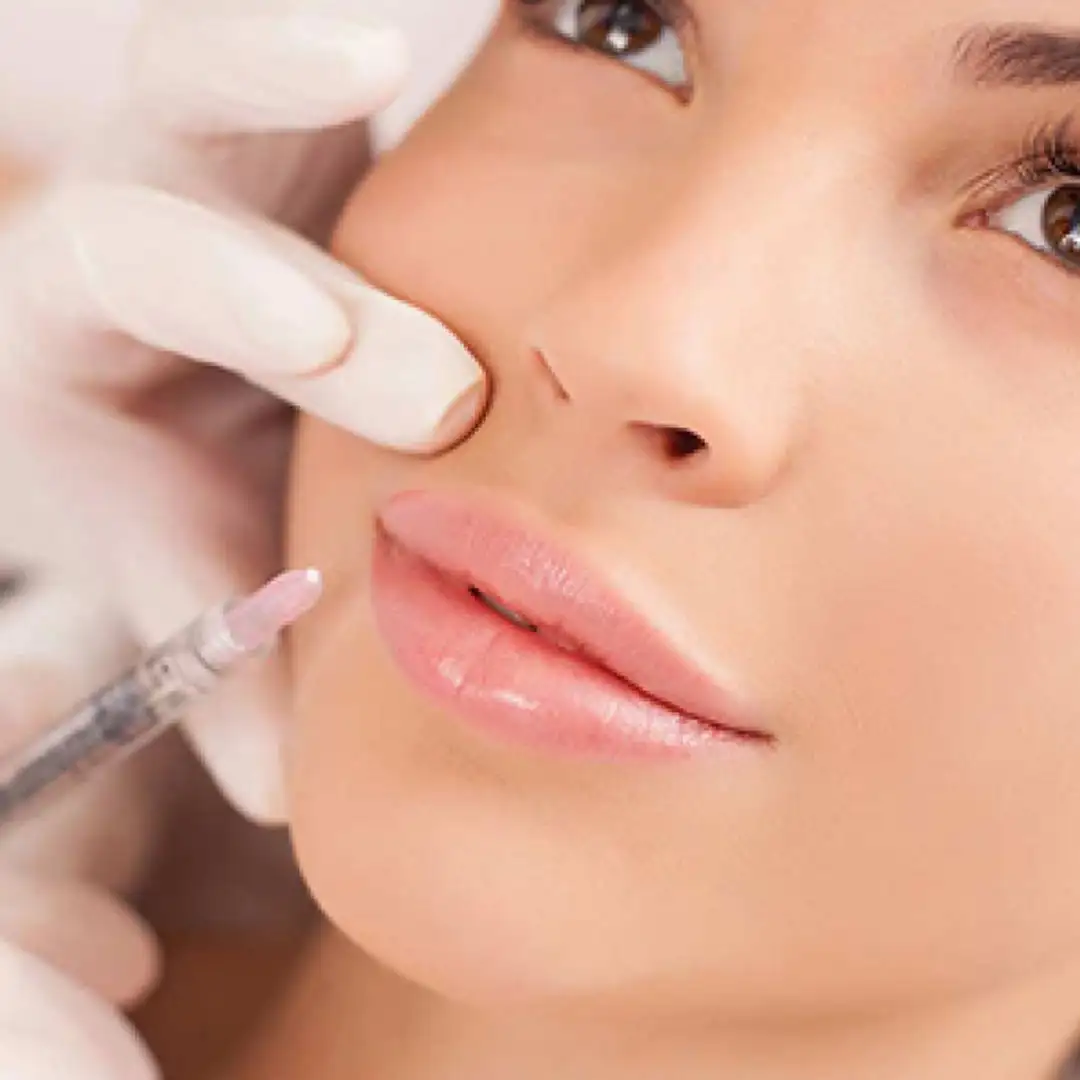 Memancungkan Hidung Dengan Cara Penyuntikan Filler Gel Bening