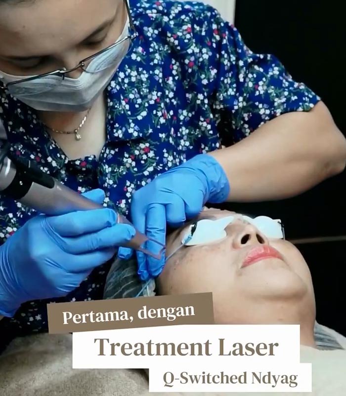 Filler Laser Combo